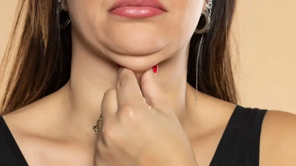 An image of a woman with double chin, sad, worried : Non Surgical Double Chin Removal Treatment in Blackheath, UK