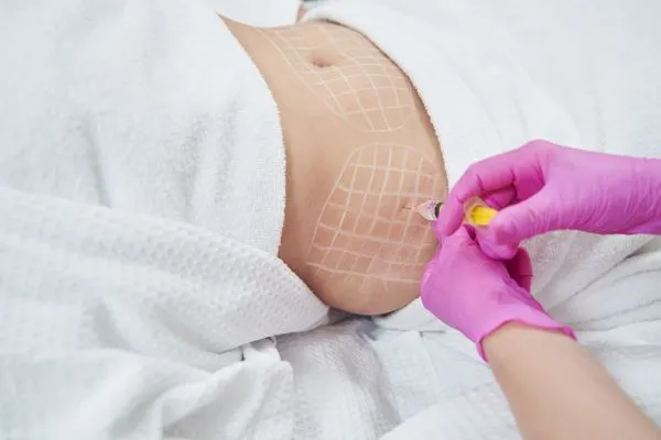 image of fat dissolving injections on love handles to help combat weight gain Blackheath